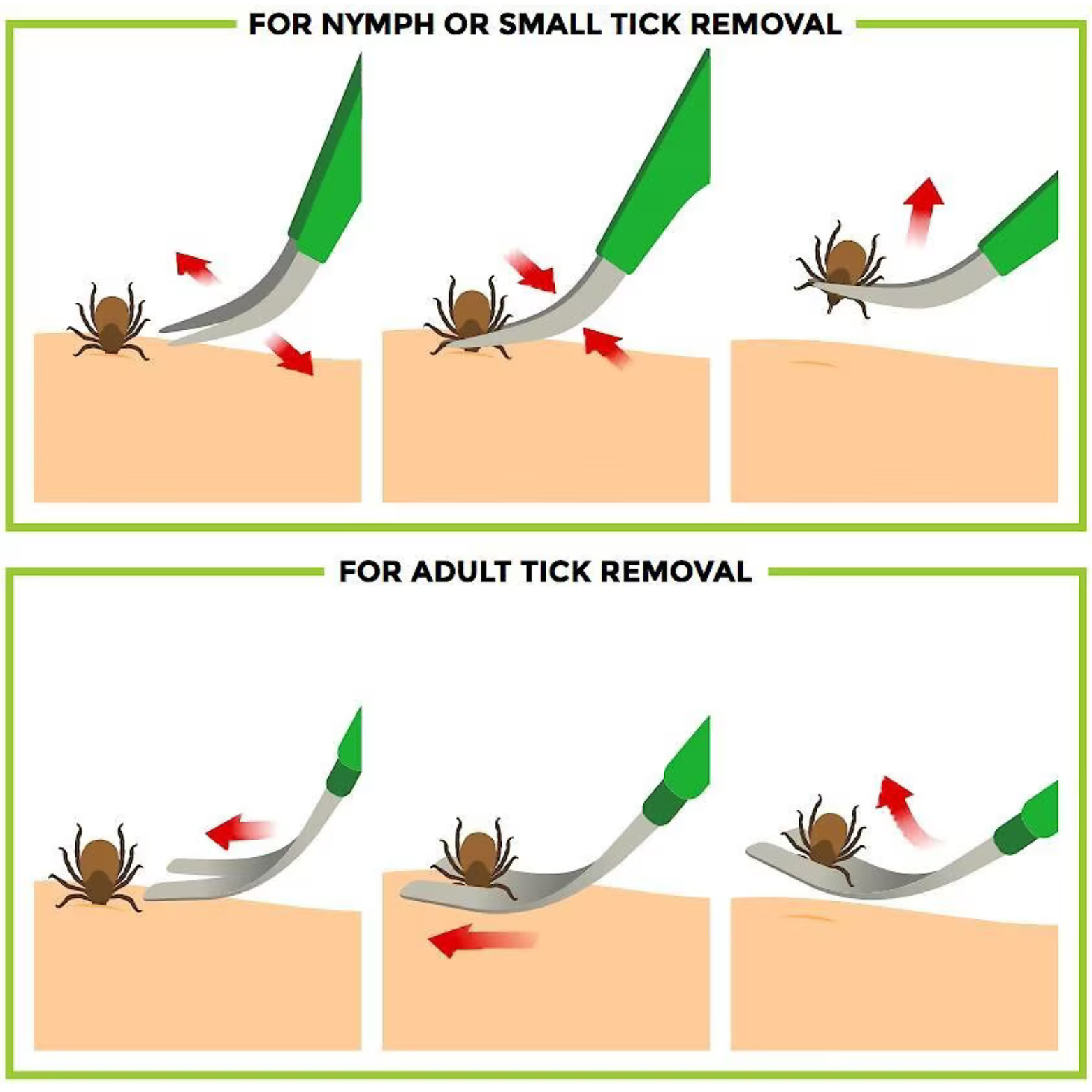 TickCheck Premium Tick Remover Set